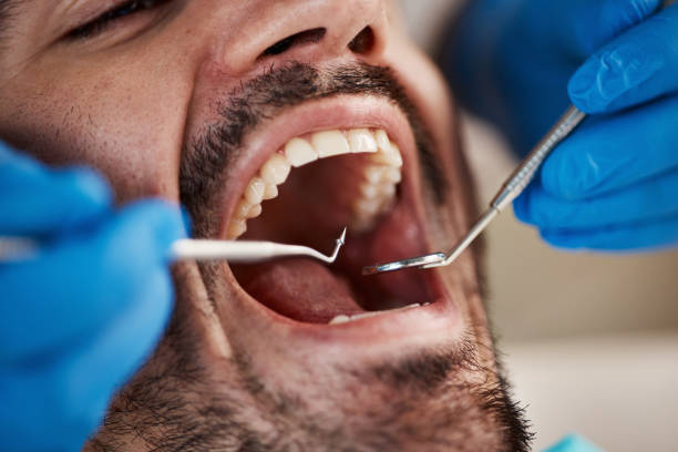 Emergency Dental Services in Ashley, OH